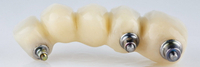 //iirorwxhloqjli5p.ldycdn.com/cloud/loBpkKloljSRilrkjnirjn/the-abutment-screw.jpg