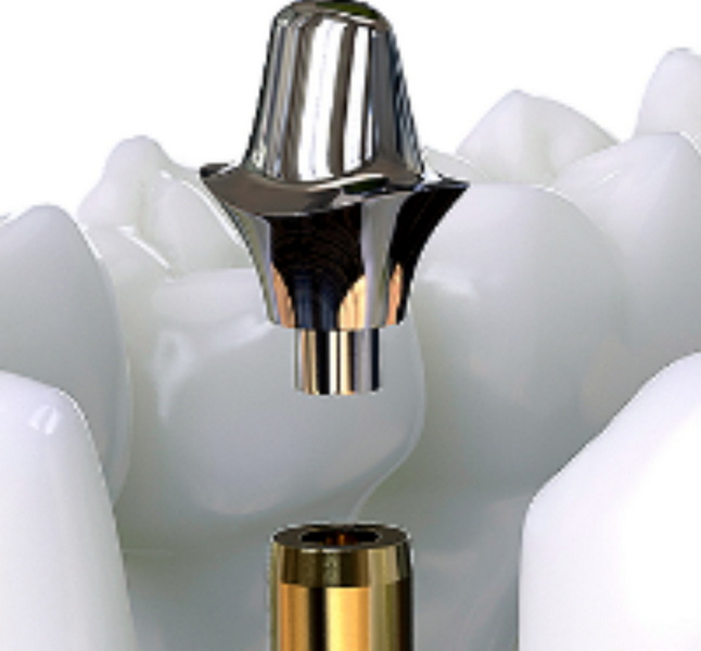 Are Straumann Abutment Torque Values Different For Custom And Standard Abutments?