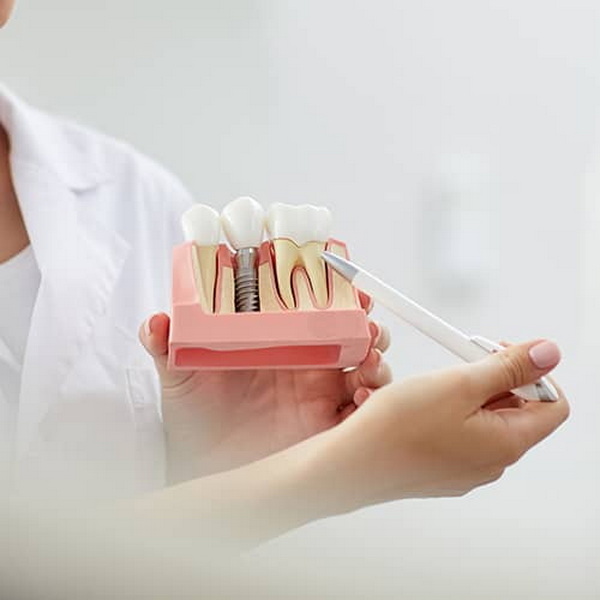 how long after dental implant surgery can i exercise_20