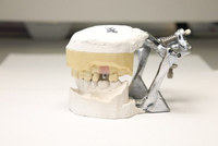 //iirorwxhloqjli5p.ldycdn.com/cloud/loBpkKloljSRrlklnnpqjq/compatible-dental-abutment-is-better-than-original.jpg