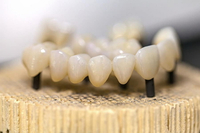//iirorwxhloqjli5p.ldycdn.com/cloud/loBpkKloljSRrlmlojmjjq/dental-abutment-bridge.jpg