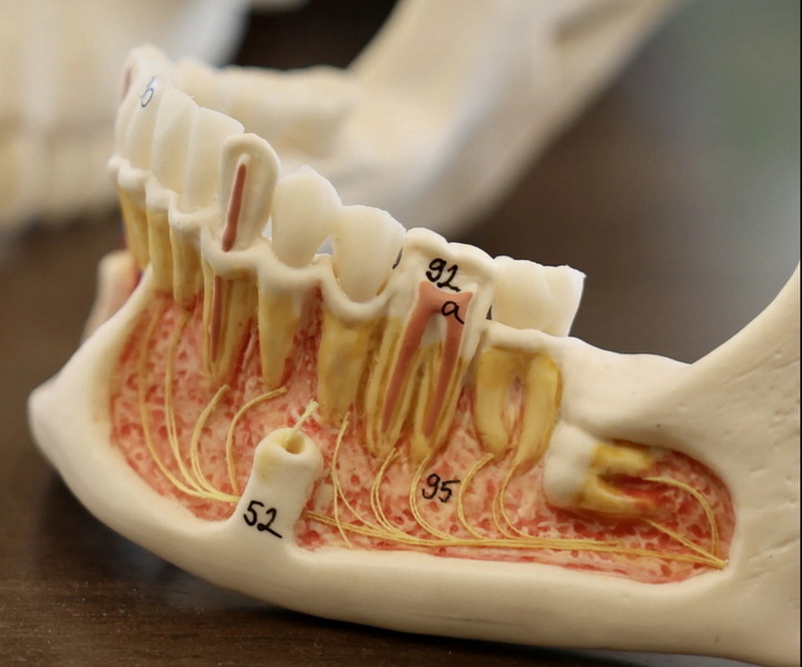 Can A Failing Dental Implant Be Saved?