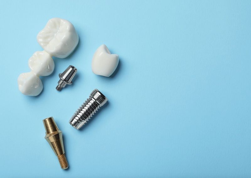 How To Prevent A Loose Implant Abutment Screw in Patients?