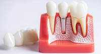 //iirorwxhloqjli5p.ldycdn.com/cloud/lpBpkKloljSRillijnqljo/straumann-rn-healing-abutment.jpg