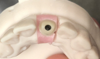 //iirorwxhloqjli5p.ldycdn.com/cloud/lpBpkKloljSRillirikljn/implant-abutment-screw-head.jpg