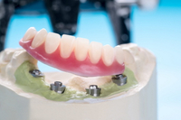 //iirorwxhloqjli5p.ldycdn.com/cloud/lpBpkKloljSRilniprnljo/do-you-get-penicillin-for-a-dental-implant.jpg