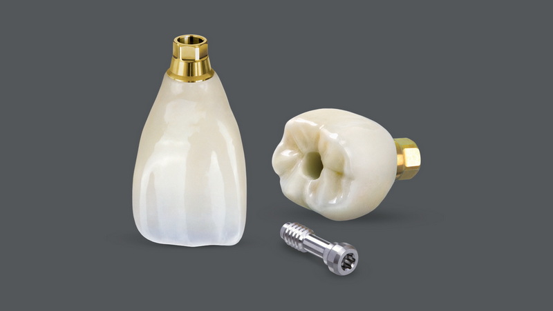 Why Is It Important To Select The Correct Size For Astra TX Healing Abutment?