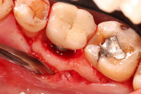 //iirorwxhloqjli5p.ldycdn.com/cloud/lpBpkKloljSRilorkmmojq/do-i-need-to-get-a-dental-implant.jpg