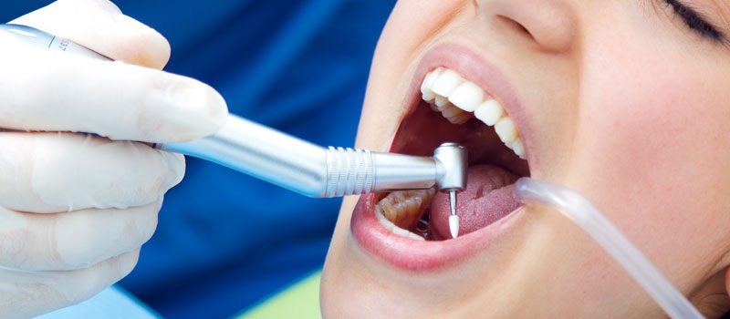 Is Dental Implant Covered by Medical Insurance?