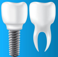 //iirorwxhloqjli5p.ldycdn.com/cloud/lpBpkKloljSRrlilrirpjn/broken-dental-abutment.jpg