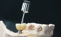 //iirorwxhloqjli5p.ldycdn.com/cloud/lpBpkKloljSRrliqrnrijn/atlantis-abutment-screw-torque.jpg