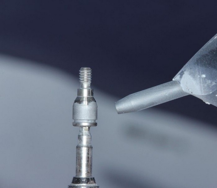 Should You Be Concerned About A Blood Clot Over A Healing Abutment?
