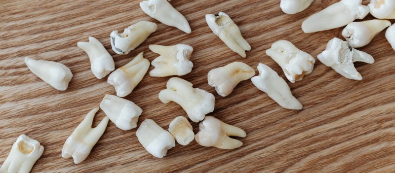 can you take gabapentin when you had a dental implant