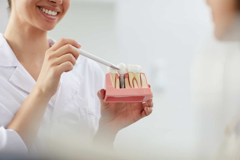Can Dental Implant Detach From Bone?