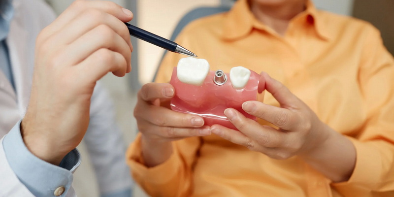 Where To Find The Best Price for A Dental Abutment And Crown?