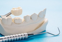 //iirorwxhloqjli5p.ldycdn.com/cloud/lqBpkKloljSRiloinlljjo/multi-unit-abutment-screw-torque.jpg