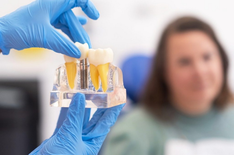 How Long Does A Dental Implant Process Take?