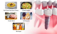 //iirorwxhloqjli5p.ldycdn.com/cloud/lqBpkKloljSRrlokmjkrjo/can-you-eat-edibles-after-dental-implant.jpg