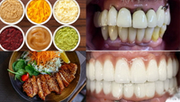 //iirorwxhloqjli5p.ldycdn.com/cloud/lqBpkKloljSRrlokmrmojq/can-you-eat-chicken-after-dental-implant.jpg