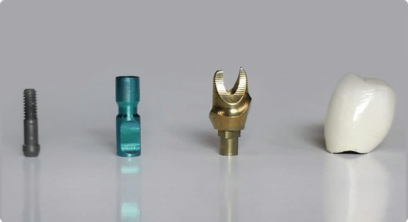 Do Dental Implant Expire?