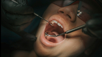 //iirorwxhloqjli5p.ldycdn.com/cloud/lqBpkKloljSRrlqlllopjq/can-you-have-a-dental-implant-on-the-nhs.jpg