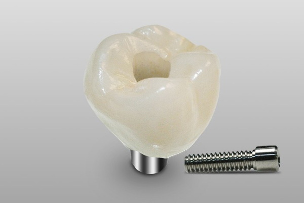 What Details Are Needed In A Custom Abutment Screw-Retained Crown Prescription?