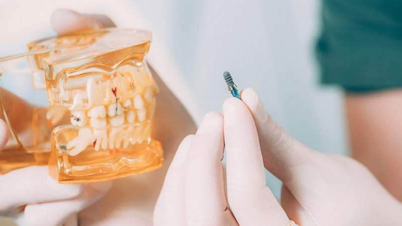 dental abutment fell out what to do