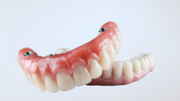 //iirorwxhloqjli5p.ldycdn.com/cloud/lrBpkKloljSRrlmlolqojp/encode-healing-abutment-numbers.jpg