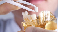 //iirorwxhloqjli5p.ldycdn.com/cloud/lrBpkKloljSRrlmlqliijq/encode-healing-abutment-sizes.jpg