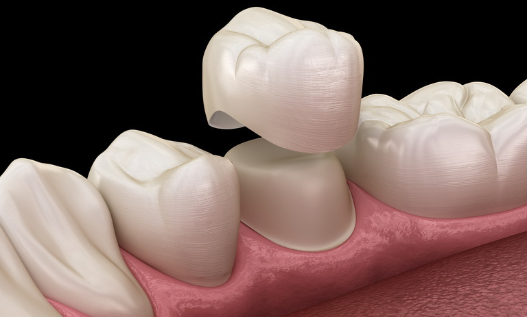 dental abutment pre mill mill blank for morse cone