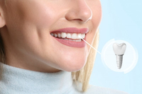 //iirorwxhloqjli5p.ldycdn.com/cloud/lrBpkKloljSRrlrlporpjq/implant-loose-abutment-screw.jpg